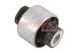 METZGER Lagerung, Lenker 52086008