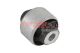 METZGER Lagerung, Lenker 52093208